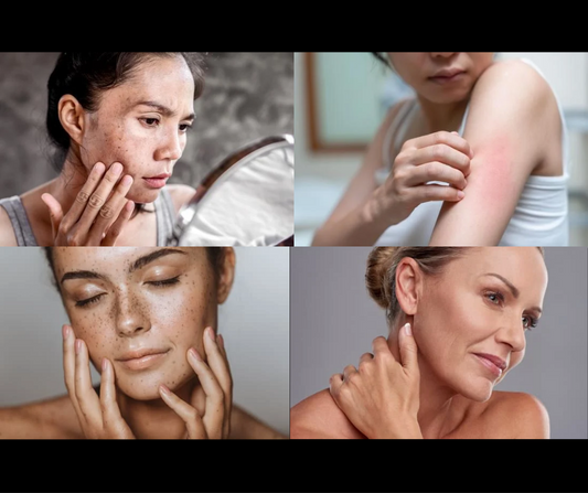 Skin cancer prevention 